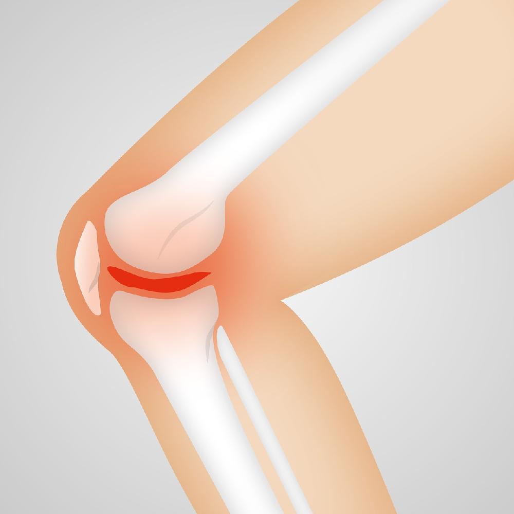 Na czym polega artroskopia kolana i jakie są wskazania do jej wykonania